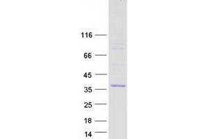 Validation with Western Blot (Adrenomedullin Protein (ADM) (Myc-DYKDDDDK Tag))