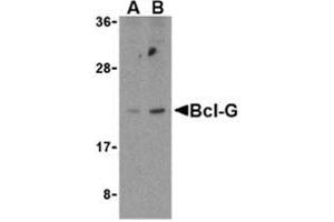 Western blot analysis of Bcl-G in U937 cell lysates with Bcl-G antibody at (A) 2. (BCL2L14 antibody  (C-Term))