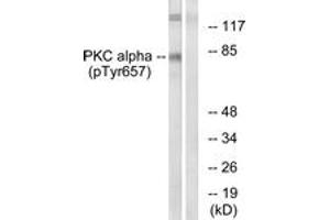 Western blot analysis of extracts from COLO205 cells, using PKC alpha (Phospho-Tyr657) Antibody. (PKC alpha antibody  (pTyr657))