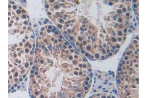 Immunohistochemistry (IHC) image for anti-Poly (ADP-Ribose) Polymerase 1 (PARP1) (AA 661-881) antibody (ABIN7439663)
