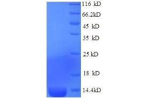 SDS-PAGE (SDS) image for Serum Amyloid A (SAA) (AA 1-110), (full length) protein (His tag) (ABIN5710310) (SAA Protein (AA 1-110, full length) (His tag))