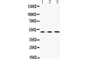 Western blot analysis of CNPase expression in rat  brain extract ( Lane 1), mouse brain extract ( Lane 2) and HELA whole cell lysates ( Lane 3). (Cnpase antibody  (Middle Region))