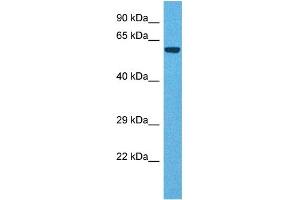 Host:  Rabbit  Target Name:  TDO2  Sample Tissue:  Human Liver Tumor  Antibody Dilution:  1ug/ml (TDO2 antibody  (N-Term))