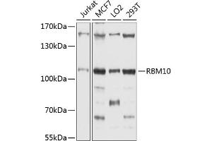 Western blot analysis of extracts of various cell lines, using RBM10 antibody (ABIN1682489, ABIN3018697, ABIN3018698 and ABIN6220546) at 1:1000 dilution. (RBM10 antibody  (AA 1-180))