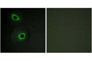 Immunofluorescence analysis of COS7 cells, using Collagen VII alpha1 Antibody. (COL7A1 antibody  (AA 1841-1890))