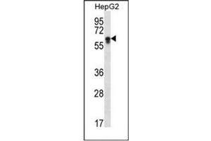 Western blot analysis of CYP2S1 Antibody (C-term) in HepG2 cell line lysates (35ug/lane). (CYP2S1 antibody  (C-Term))
