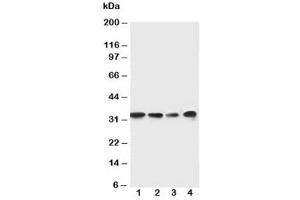 Western blot testing of MyD88 antibody and Lane 1:  rat spleen