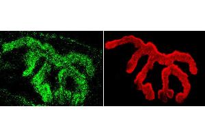 Immunohistochemistry analysis using Rabbit Anti-Piccolo Polyclonal Antibody . (Piccolo antibody  (FITC))