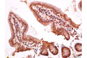 Paraformaldehyde-fixed, paraffin embedded mouse intestine, Antigen retrieval by boiling in sodium citrate buffer (pH6) for 15min, Block endogenous peroxidase by 3% hydrogen peroxide for 30 minutes, Blocking buffer (normal goat serum) at 37°C for 20min, Antibody incubation with Rabbit Anti-APOC3 Polyclonal Antibody, Unconjugated  at 1:200 overnight at 4°C, followed by a conjugated secondary for 90 minutes and DAB staining. (APOC3 antibody  (AA 41-80))