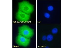 ABIN184701 Immunofluorescence analysis of paraformaldehyde fixed A431 cells, permeabilized with 0. (PLK4 antibody  (N-Term))