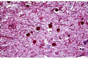 Human Brain, Cortex: Formalin-Fixed, Paraffin-Embedded (FFPE) (HMX2 antibody  (AA 125-224))