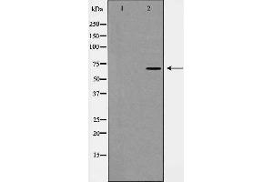 Western blot analysis of Keap1 expression in NIH 3T3 lysate,The lane on the left is treated with the antigen-specific peptide.