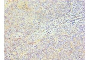 Immunohistochemistry of paraffin-embedded human tonsil tissue using ABIN7154922 at dilution of 1:100 (HSPB8 antibody  (AA 1-196))