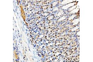 IHC analysis of SP6 using anti-SP6 antibody (ABIN5692945). (SP6 antibody)
