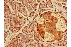 Immunohistochemistry of paraffin-embedded human pancreatic tissue using ABIN7142027 at dilution of 1:100