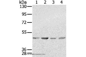 Western blot analysis of K562, 231, Raji and hela  cell, using SSB Polyclonal Antibody at dilution of 1:400 (SSB antibody)