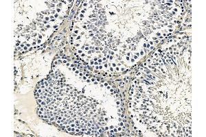 ABIN7096731 and ABIN7100796 at 1/100 staining rat testis tissue by IHC-P. (CCBL2 antibody)