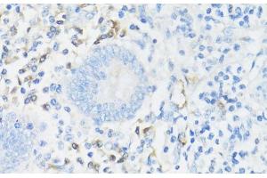 Immunohistochemistry of paraffin-embedded Human appendix using CD11A Polyclonal Antibody at dilution of 1:100 (40x lens). (ITGAL antibody)