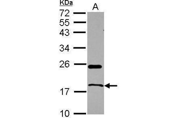 RNASE1 antibody  (Center)