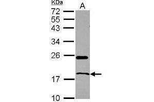 WB Image Sample (30 ug of whole cell lysate) A: U87-MG 12% SDS PAGE antibody diluted at 1:1000 (RNASE1 antibody  (Center))