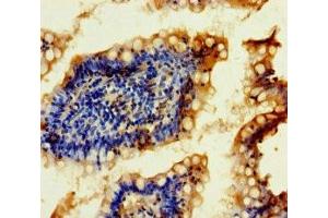 Immunohistochemistry of paraffin-embedded human small intestine tissue using ABIN7168450 at dilution of 1:100 (FTSJ2 antibody  (AA 19-246))