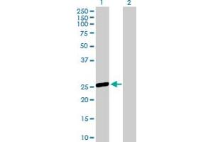 Western Blot analysis of OSTF1 expression in transfected 293T cell line by OSTF1 MaxPab polyclonal antibody. (OSTF1 antibody  (AA 1-217))