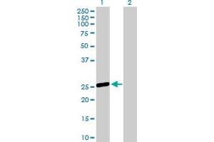 OSTF1 antibody  (AA 1-217)