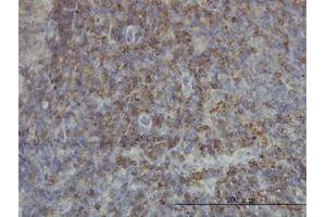 Image no. 1 for anti-SH2 Domain Containing 3C (SH2D3C) (AA 1-111) antibody (ABIN599111) (SH2D3C antibody  (AA 1-111))