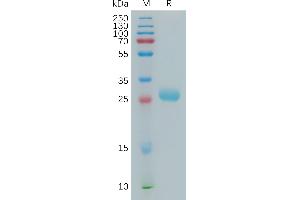 SDS-PAGE (SDS) image for Butyrophilin, Subfamily 3, Member A2 (BTN3A2) (AA 30-248) protein (His tag) (ABIN7491215)