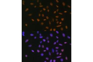Immunofluorescence (IF) image for anti-SNAIL (SNAI1) (AA 1-100) antibody (ABIN1682836)