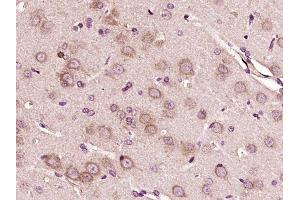 Paraformaldehyde-fixed, paraffin embedded rat brain, Antigen retrieval by boiling in sodium citrate buffer (pH6) for 15min, Block endogenous peroxidase by 3% hydrogen peroxide for 30 minutes, Blocking buffer (normal goat serum) at 37°C for 20min, Antibody incubation with VWF Polyclonal Antibody (bs-4754R) at 1:400 overnight at 4°C, followed by a conjugated secondary and DAB staining. (VWF antibody  (AA 351-450))