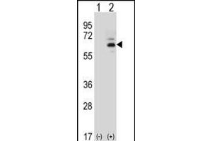 Western blot analysis of FASTK (arrow) using rabbit polyclonal FASTK Antibody (C-term) (ABIN656397 and ABIN2845692). (FASTK antibody  (C-Term))