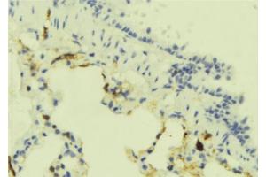 ABIN6273906 at 1/100 staining Mouse lung tissue by IHC-P. (GPR183 antibody  (Internal Region))