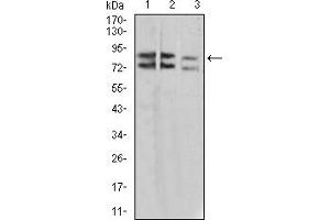 Western Blotting (WB) image for anti-Interleukin 1 Receptor Accessory Protein-Like 1 (IL1RAPL1) (AA 541-694) antibody (ABIN5925590) (IL1RAPL1 antibody  (AA 541-694))
