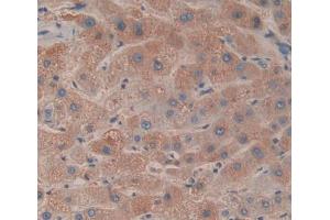 Used in DAB staining on fromalin fixed paraffin- embedded liver tissue (Medium-Chain Specific Acyl-CoA Dehydrogenase, Mitochondrial (MCAD) (AA 131-421) antibody)
