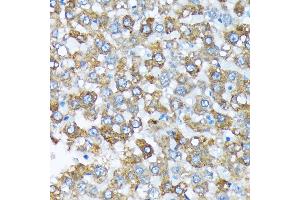 CYP4A11 antibody