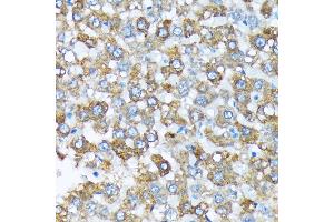 Immunohistochemistry of paraffin-embedded rat liver using Cytochrome P450 4A (CYP4) (CYP4) Rabbit mAb (ABIN7266658) at dilution of 1:100 (40x lens). (CYP4A11 antibody)