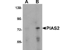 Western Blotting (WB) image for anti-Protein Inhibitor of Activated STAT, 2 (PIAS2) (N-Term) antibody (ABIN1031511) (PIAS2 antibody  (N-Term))