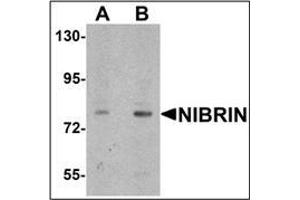 Western blot analysis of NIBRIN in rat lung tissue lysate with NIBRIN antibody (N-term) Cat. (Nibrin antibody  (N-Term))