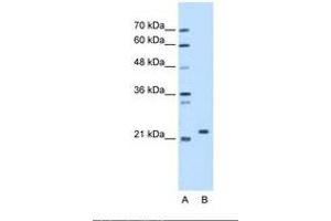 Image no. 1 for anti-Stromal Cell Derived Factor 2 (SDF2) (AA 31-80) antibody (ABIN321503)