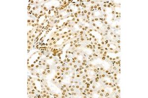 Immunohistochemistry of paraffin embedded mouse kidney using HIF-3α (ABIN7074273) at dilution of 1:1600 (400x lens) (HIF3A antibody)