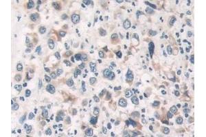 Immunohistochemistry (IHC) image for anti-Coagulation Factor II (Thrombin) Receptor-Like 3 (F2RL3) (AA 48-385) antibody (ABIN7431131)