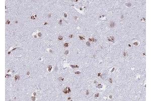 Immunohistochemistry (IHC) image for anti-Cathepsin D (CTSD) (C-Term) antibody (ABIN6260500)