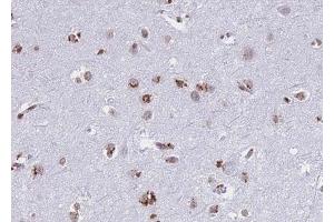 ABIN6268739 at 1/100 staining human brain tissue sections by IHC-P. (Cathepsin D antibody  (C-Term))