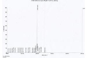 Image no. 1 for Pro-Brain Natriuretic Peptide (NT-ProBNP) (NT-ProBNP) (N-Term) peptide (Ovalbumin) (ABIN5666287)
