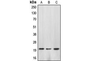 Western blot analysis of Caspase 4 p20 expression in HepG2 colchicine-treated (A), SP2/0 H2O2-treated (B), rat kidney (C) whole cell lysates. (Caspase 4 p20 (Center) antibody)