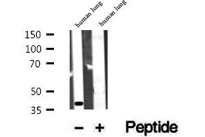 Western blot analysis of extracts of human lung tissue, using ACAA1 antibody. (ACAA1 antibody  (N-Term))