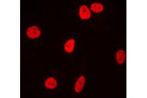 Immunofluorescent analysis of Ku80 staining in HeLa cells. (XRCC5 antibody  (C-Term))