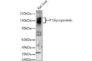 Western blot analysis of extracts of Rat liver, using P Glycoprotein antibody (ABIN7265732) at 1:500 dilution. (ABCB1 antibody)