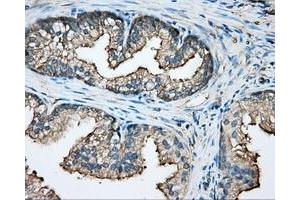 Immunohistochemical staining of paraffin-embedded pancreas tissue using anti-CAPZA1 mouse monoclonal antibody.